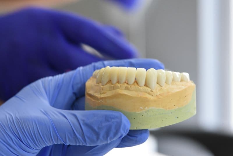DENTAL IMPLANTS
